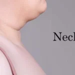 Fat Neck