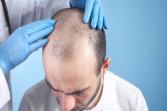 Hair Transplant in Abu Dhabi: A Comprehensive Guide to the Procedure