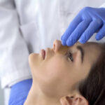 Rhinoplasty in Abu Dhabi