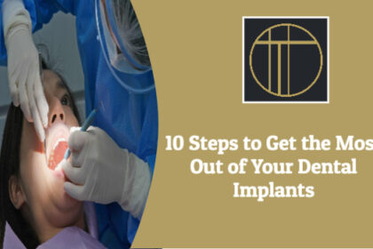 Dental Implants